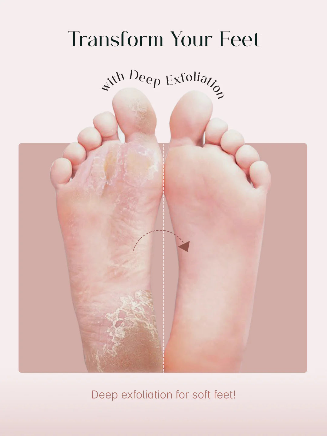 Glycolic Acid Foot Peeling Mask (PACK OF 2)