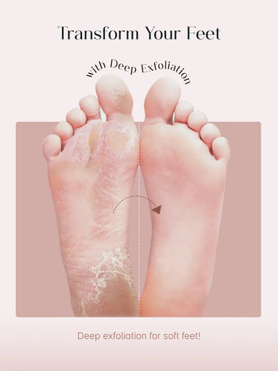 Glycolic Acid Foot Peeling Mask (PACK OF 2)